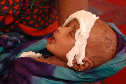 2.5 מיליון סומלים מצויים בסכנת גוויעה ברעב