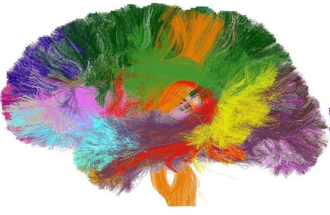 הושלמה הכנת האטלס המלא של המוח האנושי