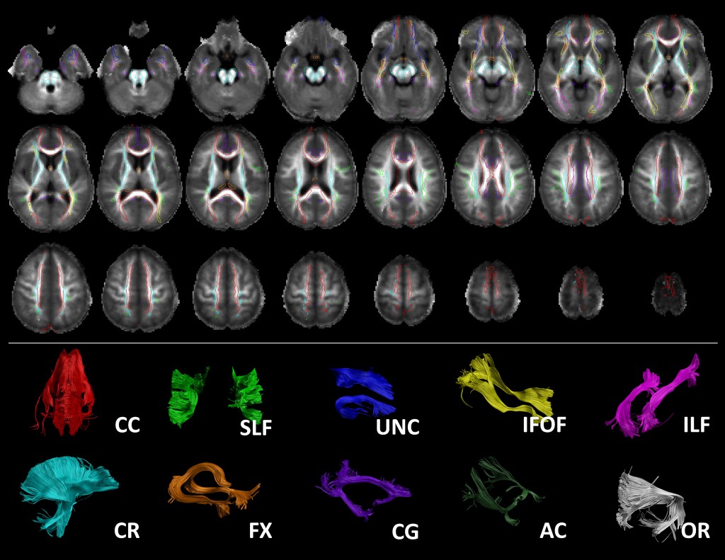 אטלס המוח - צילומי MRI - (באדיבות אוניברסיטת ת"א)