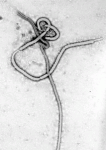 נגיף האבולה מבעד למיקרוסקופ אלקטרוני. צילום: ויקיפדיה