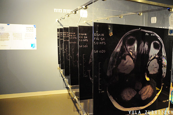 תערוכת מוח- פרוסות מוח בצילומי MRI.צילום: יולה זובריצקי